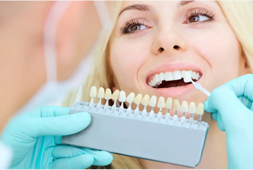 Types of Teeth Whitening Services