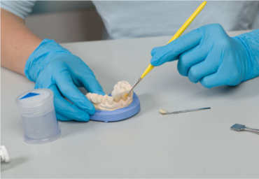 Everything You Need to Know About Dental Implants and Bone Grafting 2023